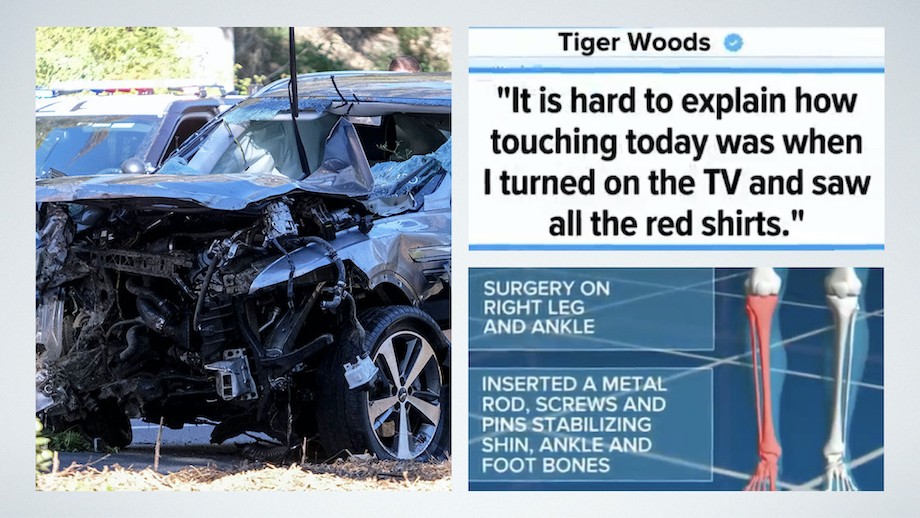 Tiger Woods Surgery
